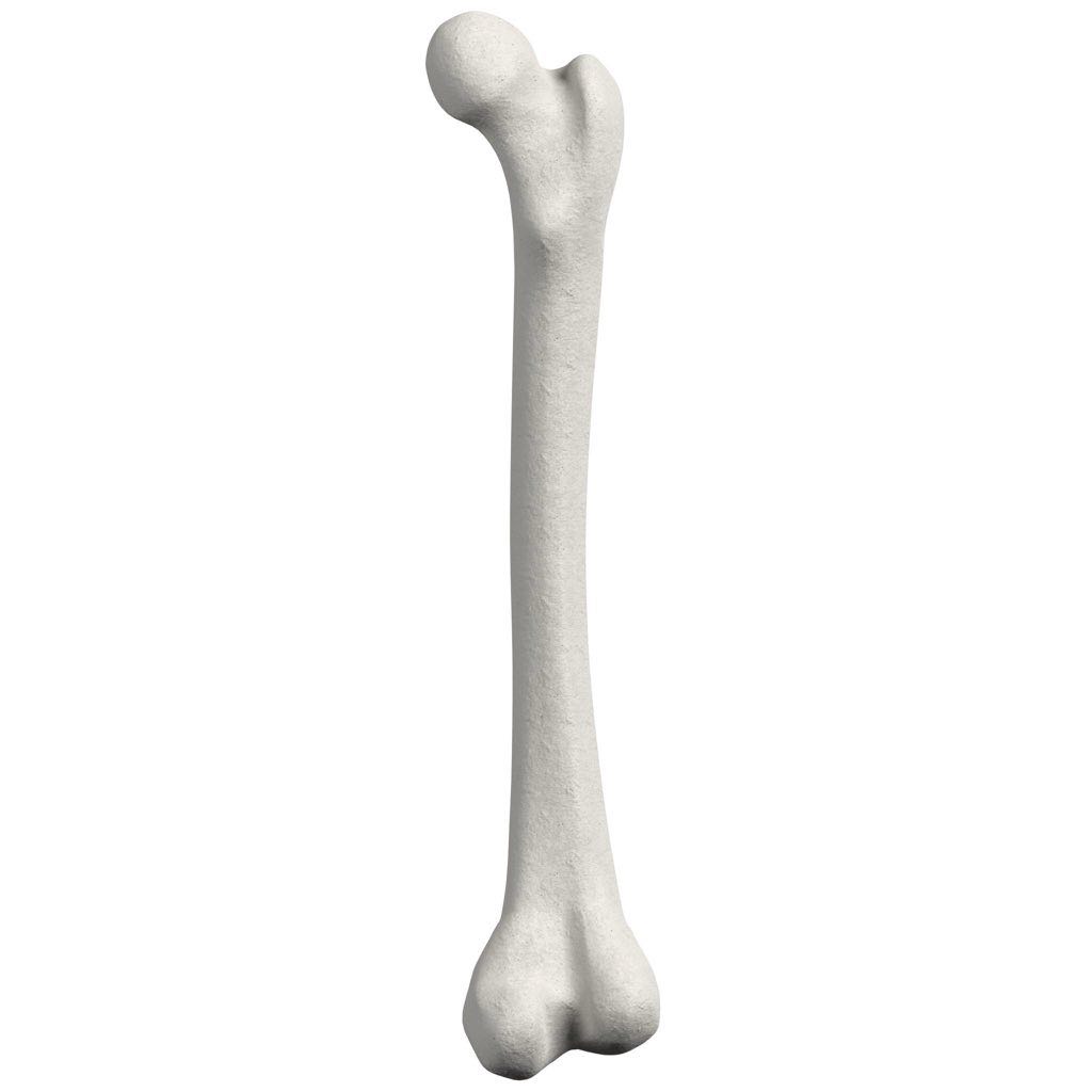 Distal femoral osteotomy (DFO) in Reading — Mr Sam Nahas Anatomical illustration of the distal femur (thigh bone)